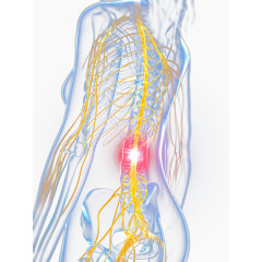 女性背部医疗X光