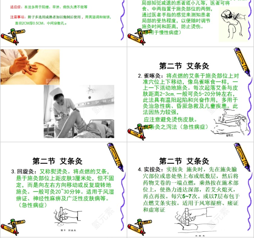 中医灸法学培训PPT第6张