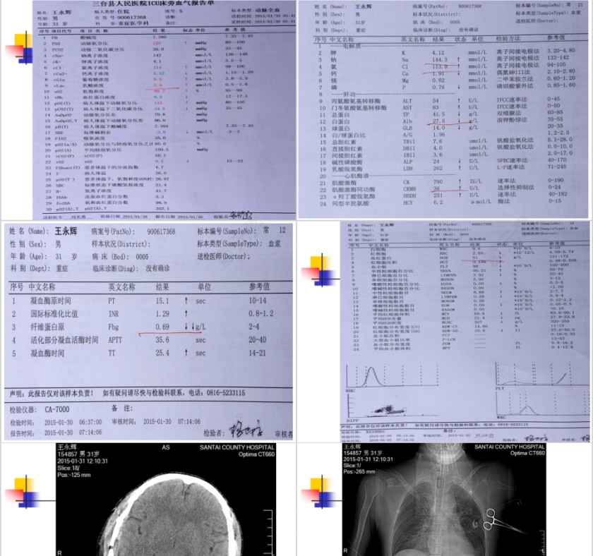 病例汇报PPT第7张