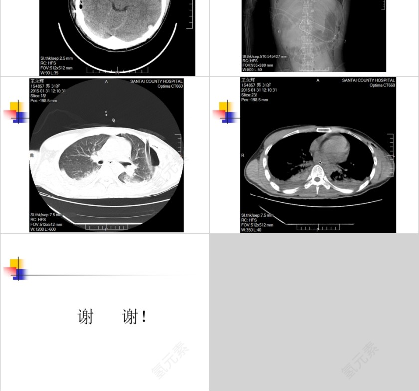 病例汇报PPT第8张