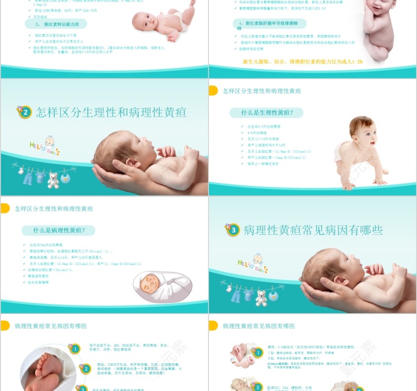 婴儿护理实用指南新生儿黄疸护理培训PPT第2张