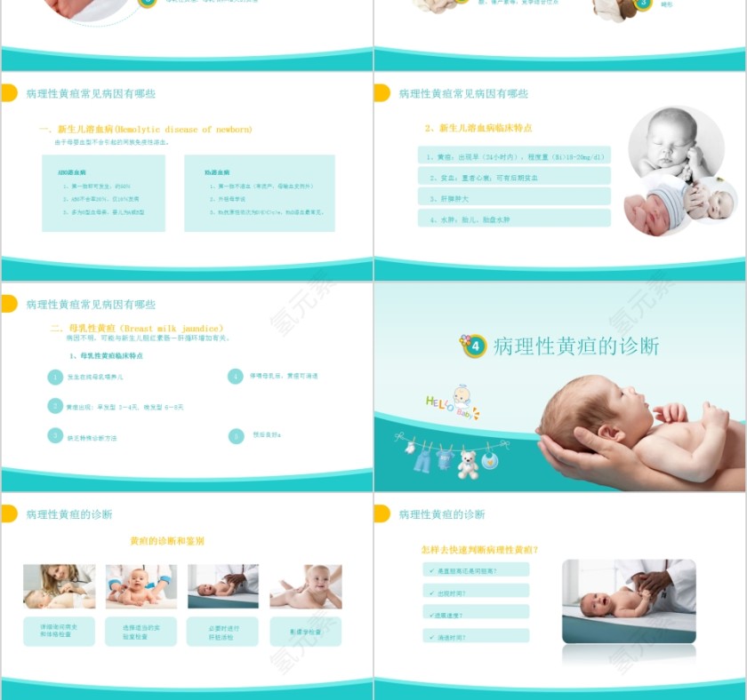 婴儿护理实用指南新生儿黄疸护理培训PPT第3张