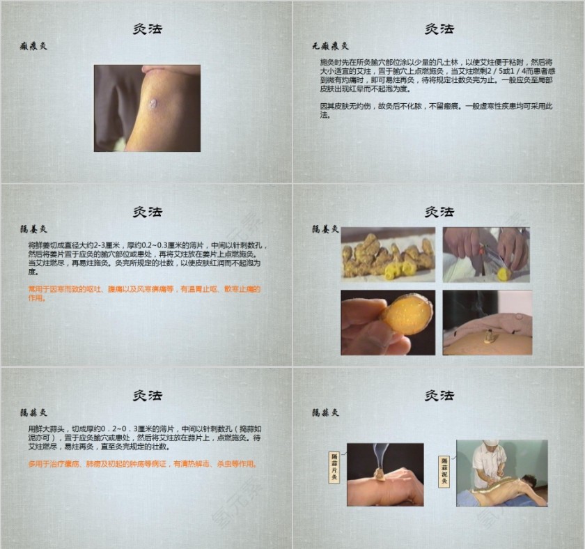 艾灸疗法培训PPT课件第4张