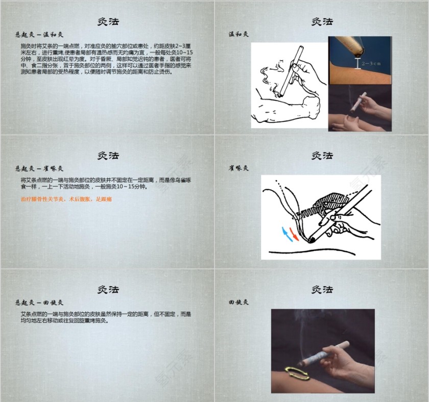 艾灸疗法培训PPT课件第6张