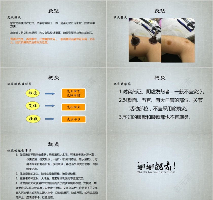 艾灸疗法培训PPT课件第8张