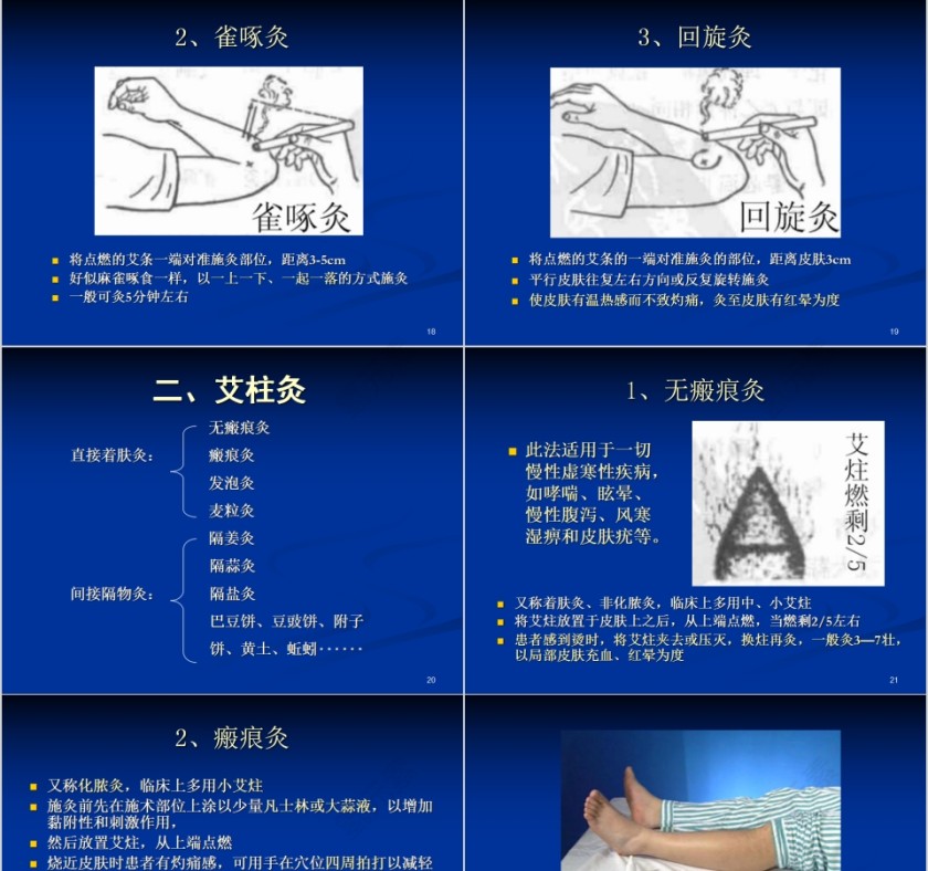 简约清新艾灸与保健培训PPT课件第5张