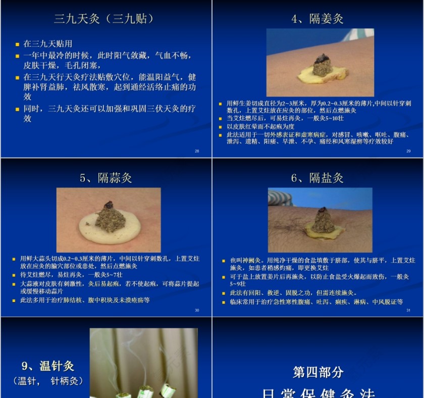 简约清新艾灸与保健培训PPT课件第7张