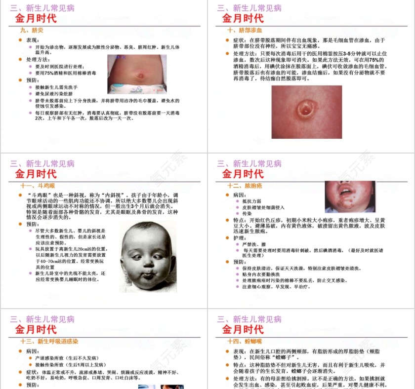 月嫂培训新生儿护理ppt第11张