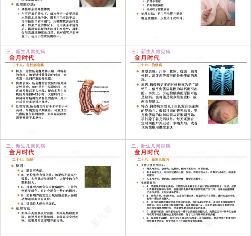 月嫂培训新生儿护理ppt第14张