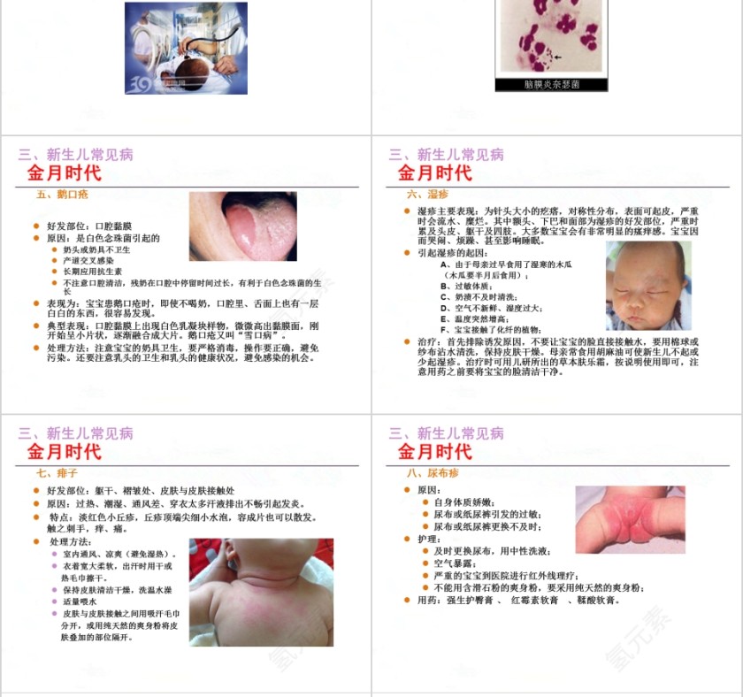 月嫂培训新生儿护理ppt第10张
