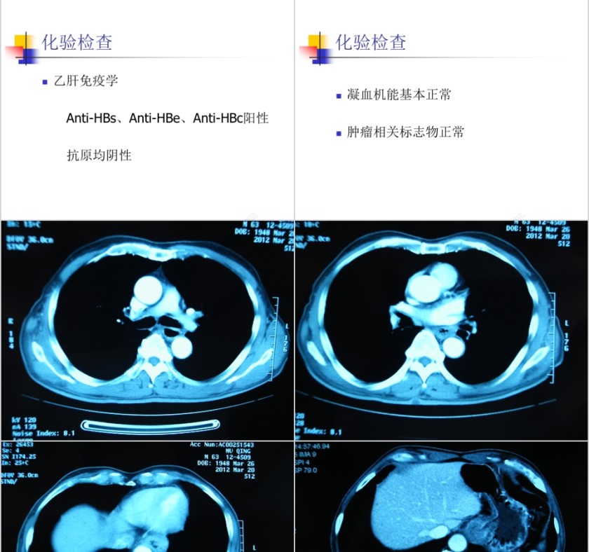 病例汇报PPT模板第3张