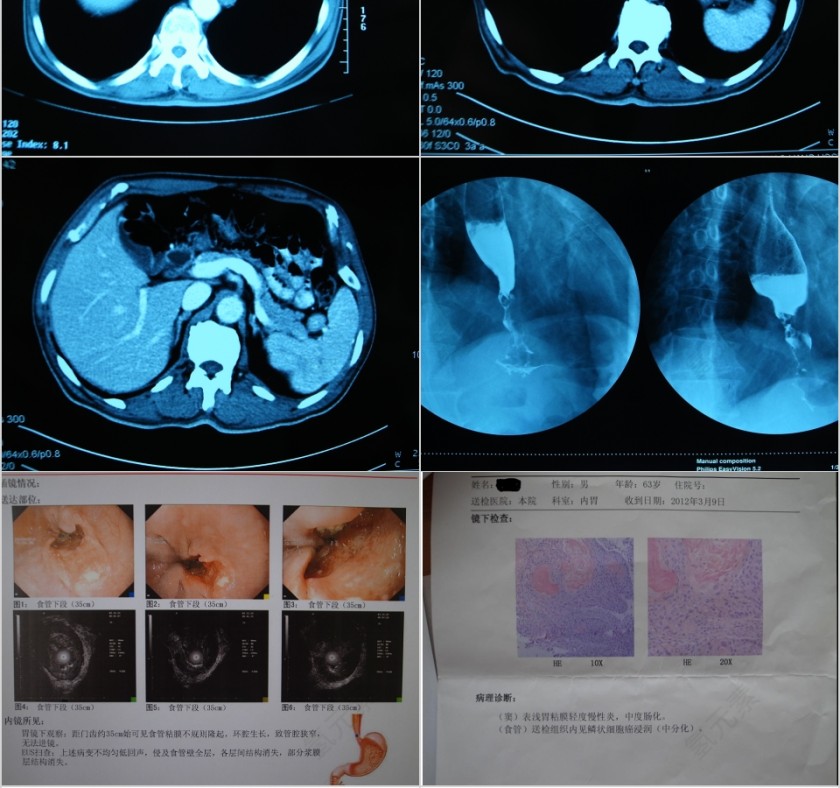 病例汇报PPT模板第4张