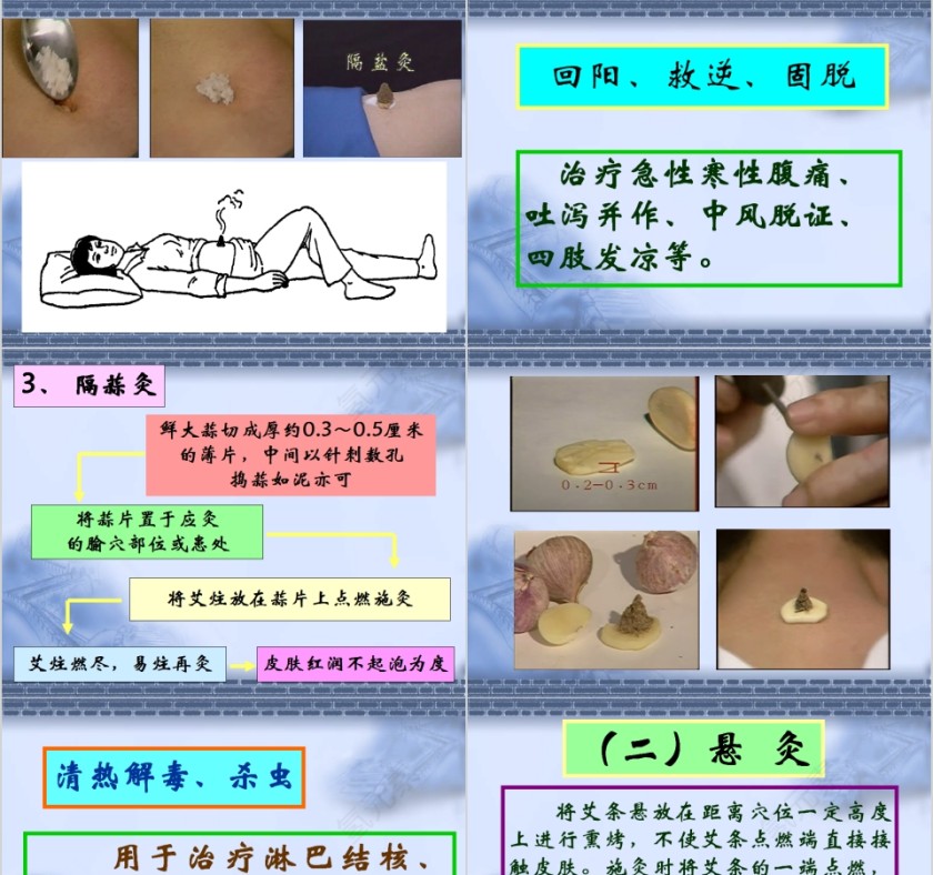 艾灸疗法培训PPT课件 第5张