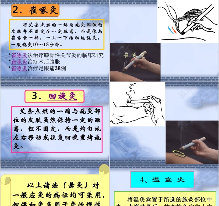 艾灸疗法培训PPT课件 第7张