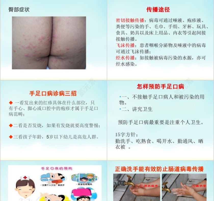 让孩子远离手足口病预防传染病手足口病主题班会模板第3张