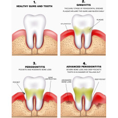 矢量牙齿和坏牙