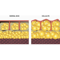 皮肤结构图图片
