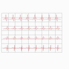 红色心电图矢量素材