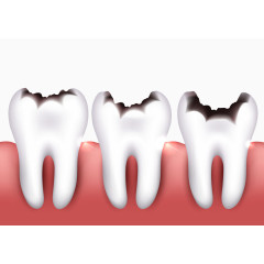 被虫咬坏的牙齿