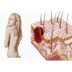 皮肤发炎图片