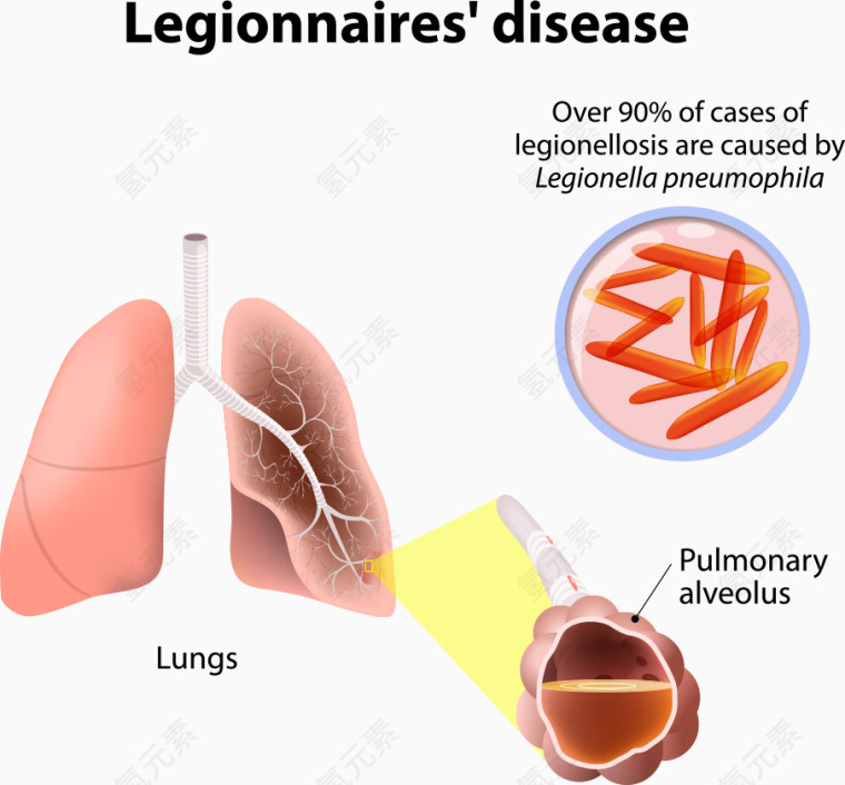 矢量肺内细胞