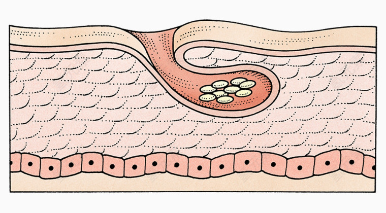 皮肤结构插图