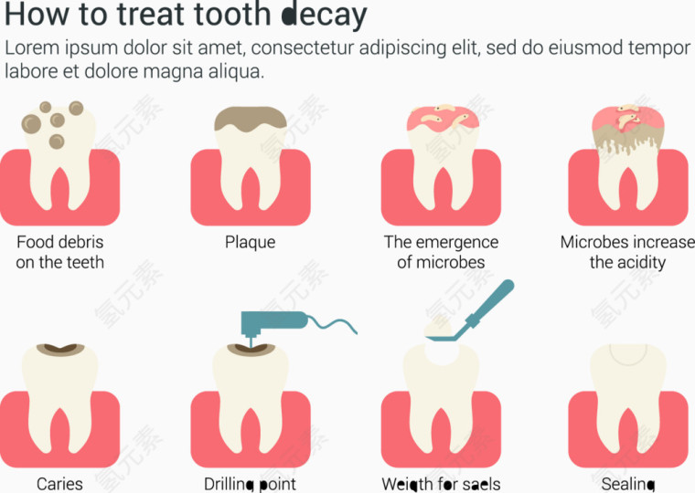 如何治疗龋齿信息图表矢量素材