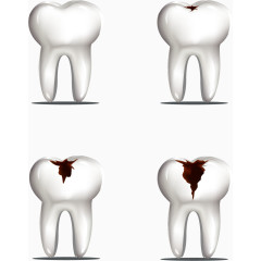 矢量手绘蛀牙