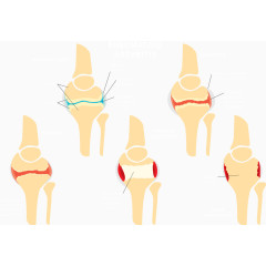 矢量图人体骨骼