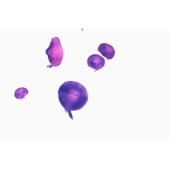 水母