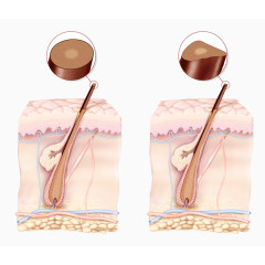 毛囊细胞组织图片