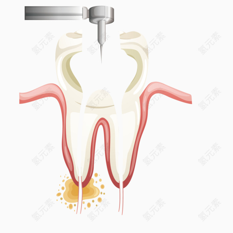 矢量艺术牙齿救治