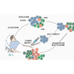 干细胞移植技术 抗肿瘤