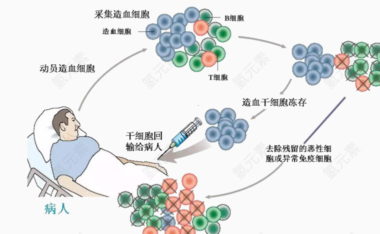 干细胞移植技术 抗肿瘤