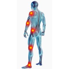 人体骨骼关节炎