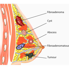 矢量乳房分解图