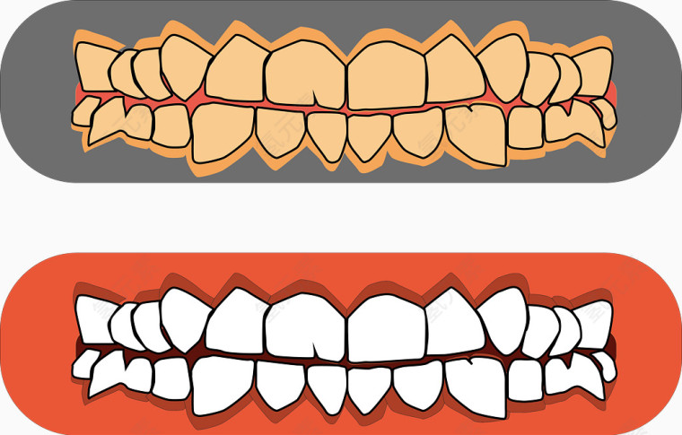 矢量图牙齿