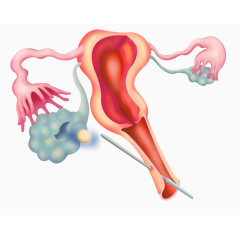 生殖系统医疗插图