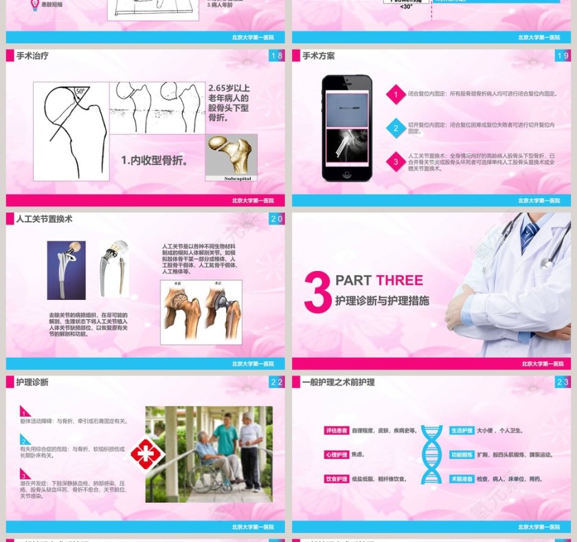 股骨颈骨折护理查房课件PPT第4张