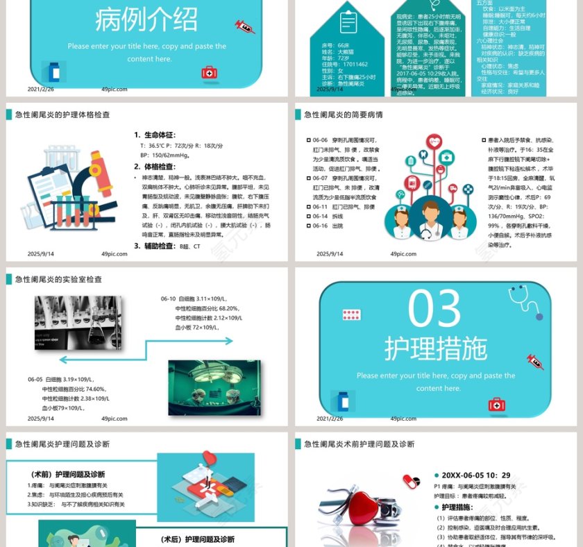 急性阑尾炎护理查房PPT模板第3张