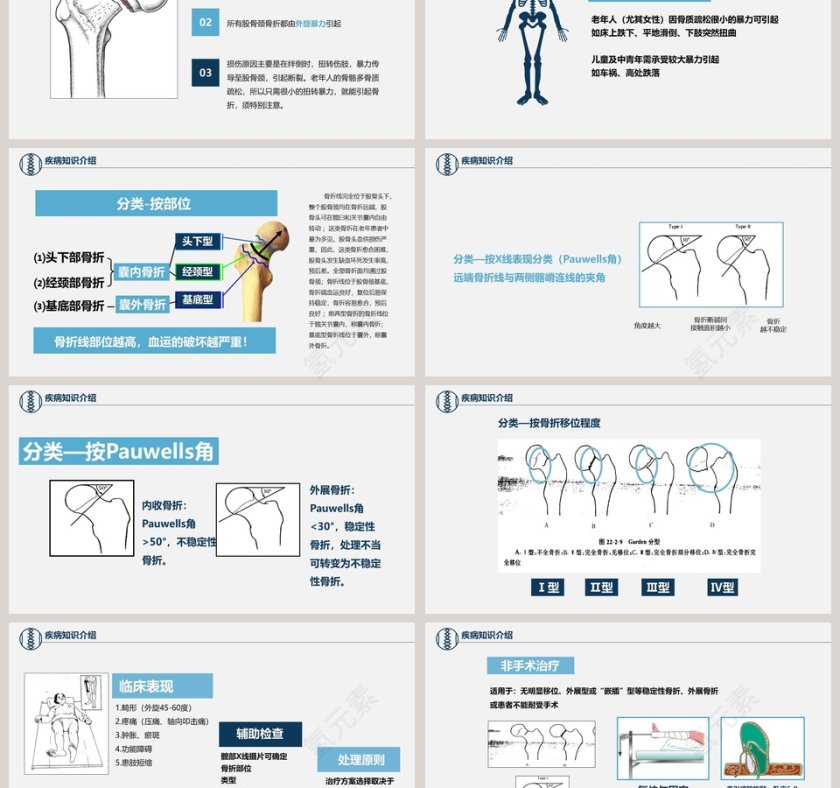 股骨颈骨折护理查房ppt 第3张