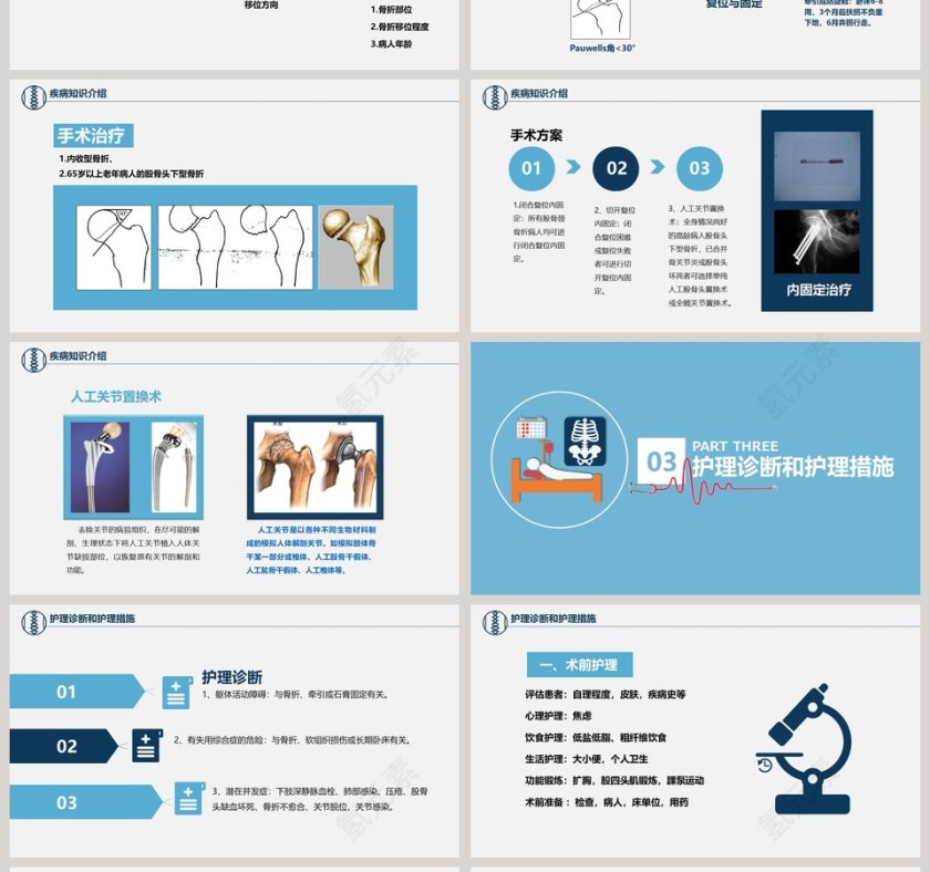 股骨颈骨折护理查房ppt 第4张