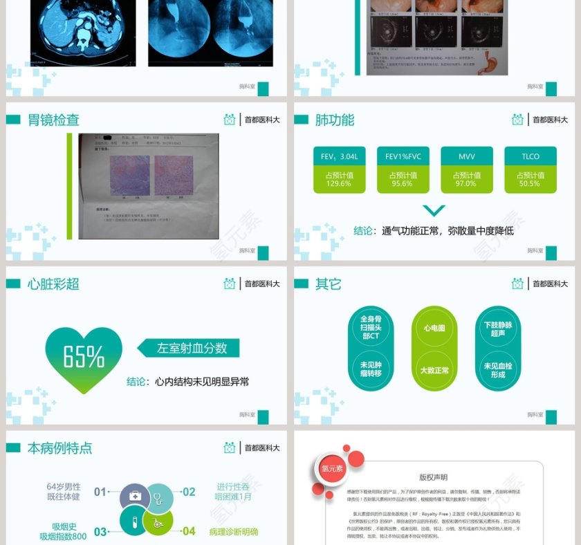 青绿色医院病例汇报简约医生护士工作报告通用PPT模板第3张