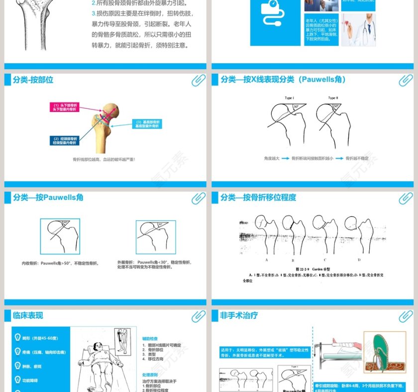 股骨颈骨折护理查房课件PPT第3张