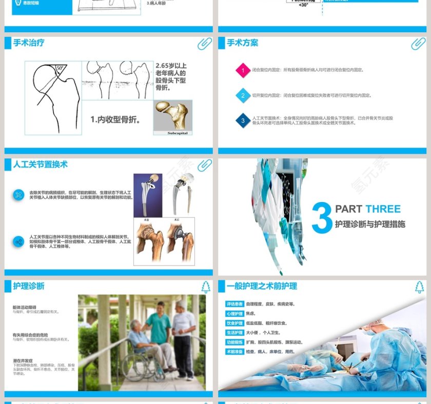 股骨颈骨折护理查房课件PPT第4张