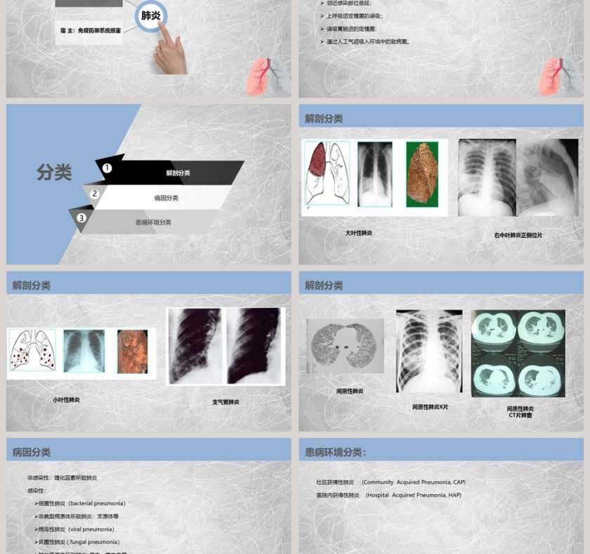 肺部感染性疾病培训课件PPT第3张