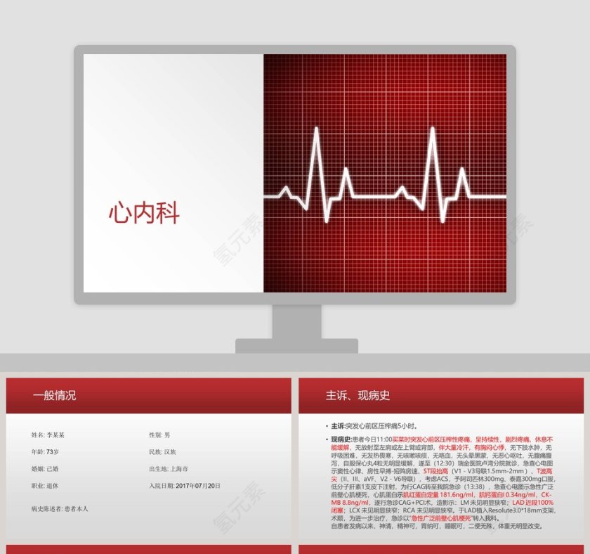 心梗病例汇报PPT第1张