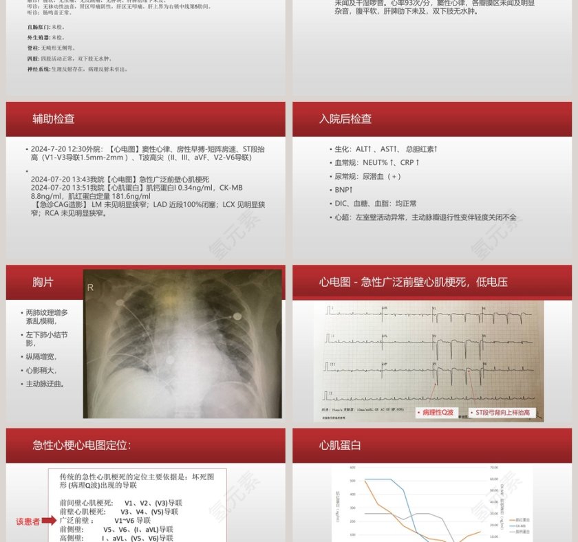 心梗病例汇报PPT第3张
