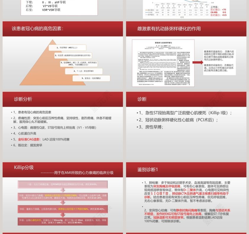 心梗病例汇报PPT第4张