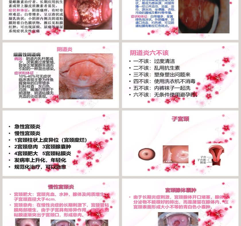 简约清新妇科健康知识讲座PPT模板第3张